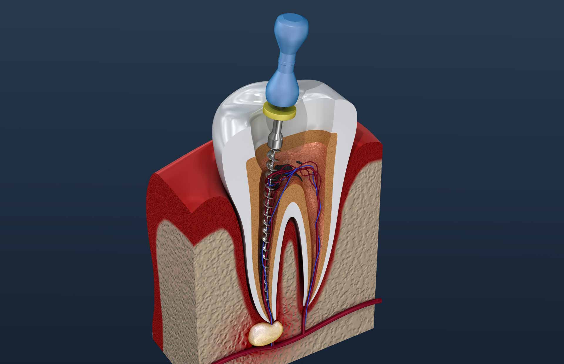 Endodonzia​